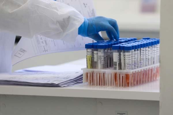 Casos de ‘monkeypox’ são importados: Estado não tem transmissão (Foto: Geraldo Bubniak/AN-PR)